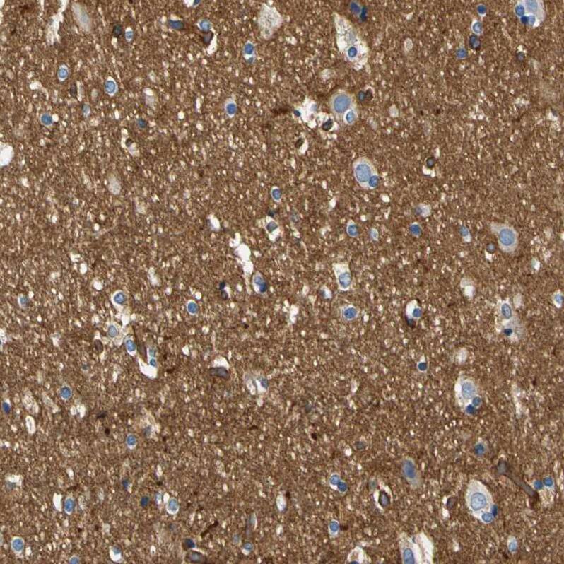 Spectrin beta 2 Antibody - BSA Free Immunohistochemistry-Paraffin: Spectrin beta 2 Antibody - BSA Free [NBP1-86088]