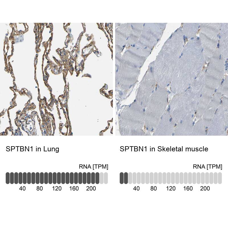 Spectrin beta 2 Antibody - BSA Free Immunohistochemistry-Paraffin: Spectrin beta 2 Antibody - BSA Free [NBP1-86088]