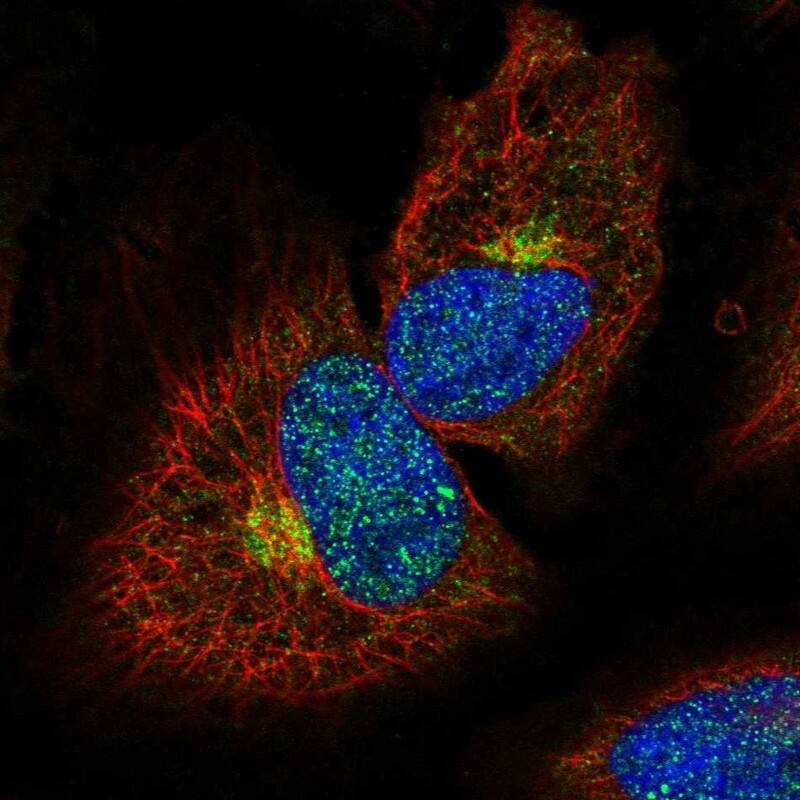 MPPE1 Antibody - BSA Free Immunocytochemistry/ Immunofluorescence: MPPE1 Antibody [NBP1-86089]