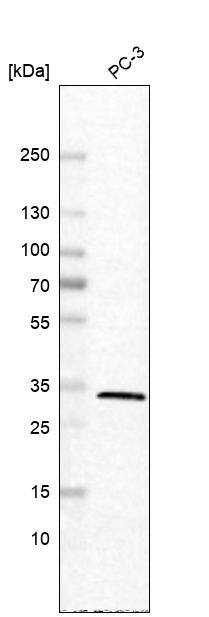 Carbonic Anhydrase VB/CA5B Antibody - BSA Free Western Blot: Carbonic Anhydrase VB/CA5B Antibody - BSA Free [NBP1-86090]