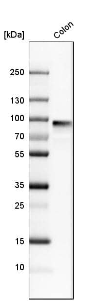 pIgR Antibody - BSA Free Western Blot: pIgR Antibody - BSA Free [NBP1-86095]