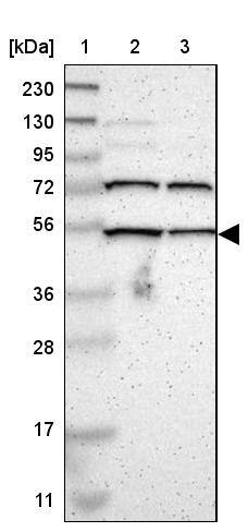 EFCAB14 Antibody - BSA Free Western Blot: EFCAB14 Antibody - BSA Free [NBP1-86098]