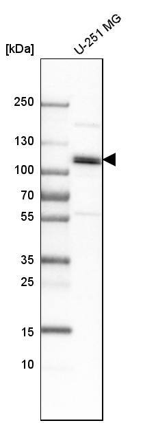CUL4B Antibody - BSA Free Western Blot: CUL4B Antibody - BSA Free [NBP1-86099]