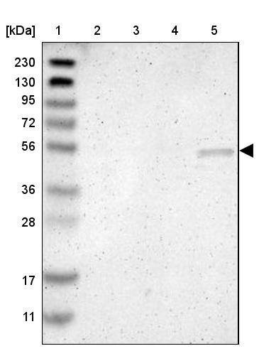 SGK2 Antibody - BSA Free Western Blot: SGK2 Antibody - BSA Free [NBP1-86102]