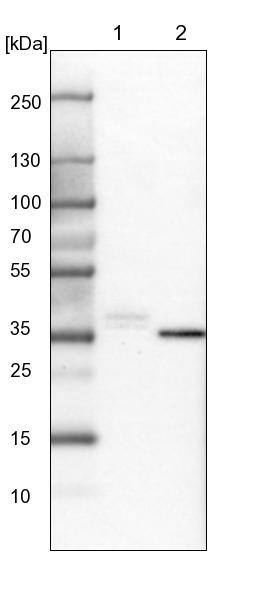 SGK2 Antibody - BSA Free Western Blot: SGK2 Antibody - BSA Free [NBP1-86102]