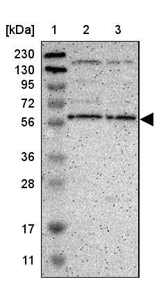 EFCAB14 Antibody - BSA Free Western Blot: EFCAB14 Antibody - BSA Free [NBP1-86104]