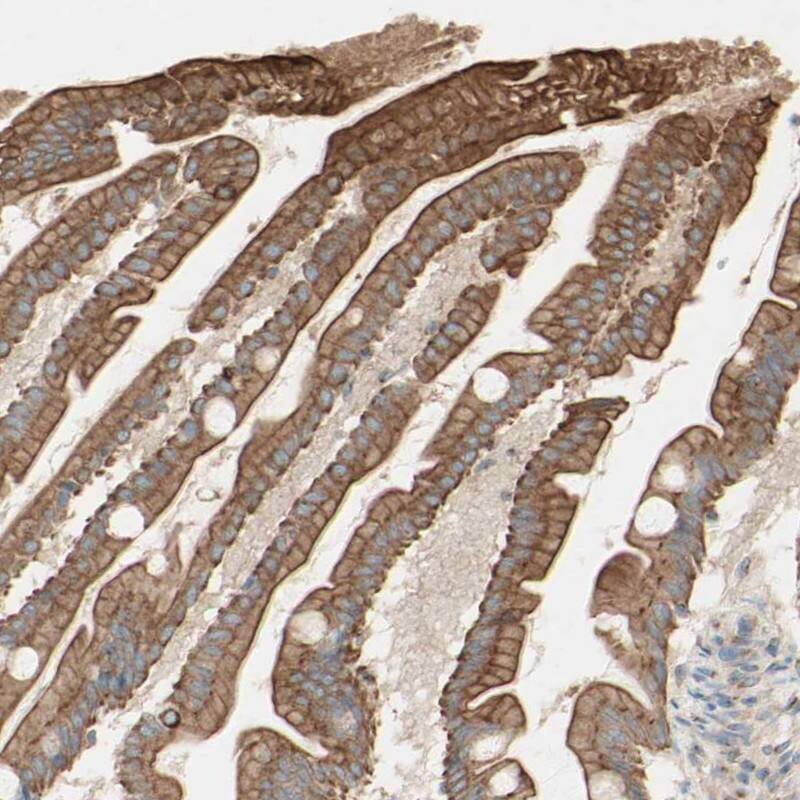 Myotubularin Antibody - BSA Free Immunohistochemistry-Paraffin: Myotubularin Antibody [NBP1-86107]