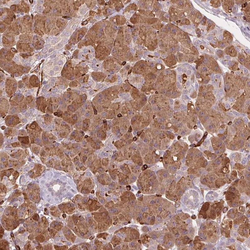 CLPS Antibody - BSA Free Immunohistochemistry-Paraffin: CLPS Antibody - BSA Free [NBP1-86109]