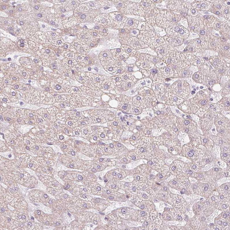 CLPS Antibody - BSA Free Immunohistochemistry-Paraffin: CLPS Antibody - BSA Free [NBP1-86109]