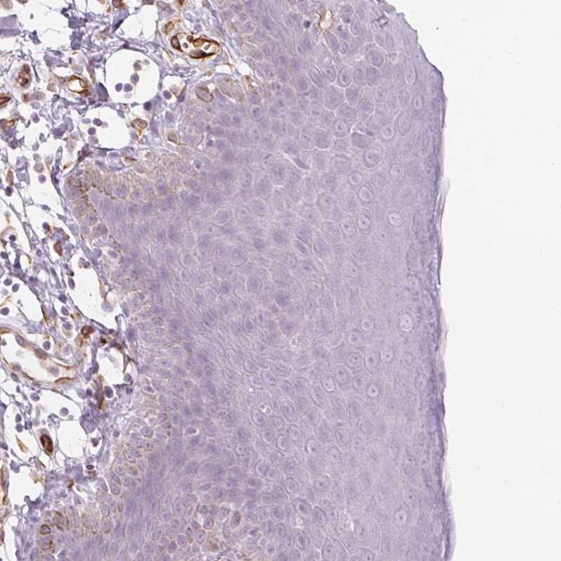 CLPS Antibody - BSA Free Immunohistochemistry-Paraffin: CLPS Antibody - BSA Free [NBP1-86109]