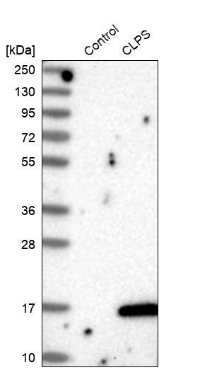 CLPS Antibody - BSA Free Western Blot: CLPS Antibody - BSA Free [NBP1-86109]
