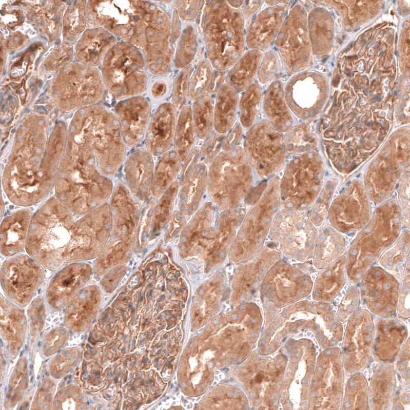 Myotubularin Antibody - BSA Free Immunohistochemistry-Paraffin: Myotubularin Antibody [NBP1-86113]