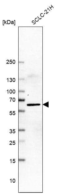 LHX9 Antibody - BSA Free Western Blot: LHX9 Antibody - BSA Free [NBP1-86114]