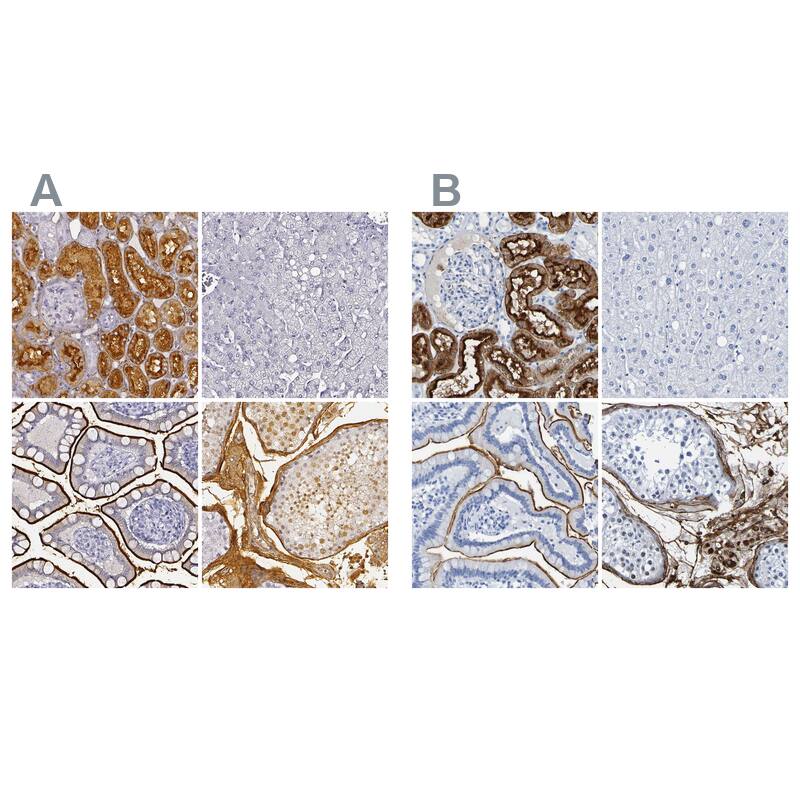 DPEP1 Antibody - BSA Free Immunohistochemistry-Paraffin: DPEP1 Antibody - BSA Free [NBP1-86115]