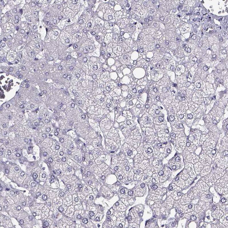 DPEP1 Antibody - BSA Free Immunohistochemistry-Paraffin: DPEP1 Antibody - BSA Free [NBP1-86115]