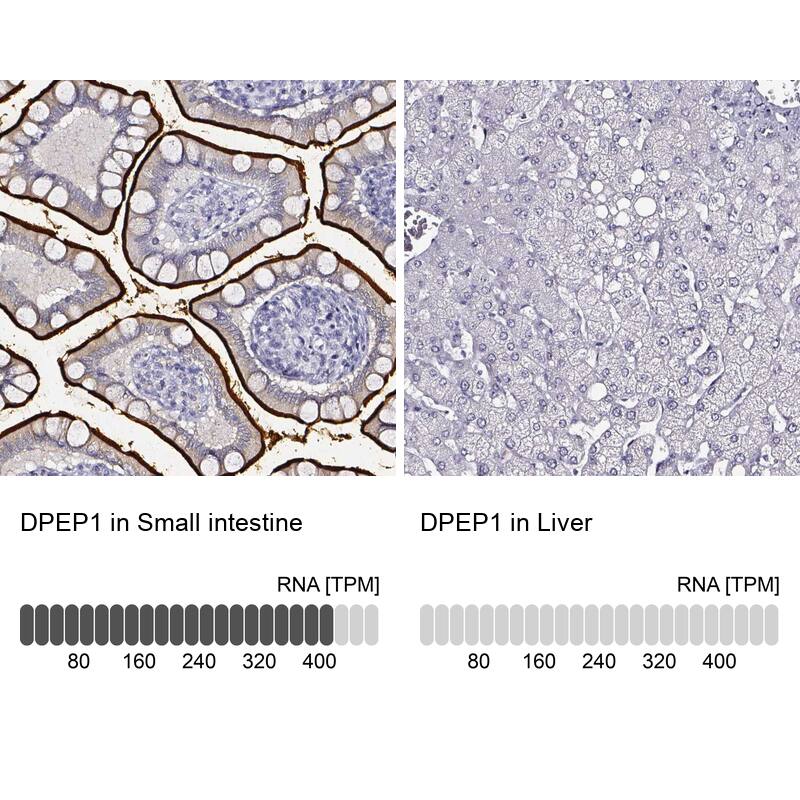 DPEP1 Antibody - BSA Free Immunohistochemistry-Paraffin: DPEP1 Antibody - BSA Free [NBP1-86115]
