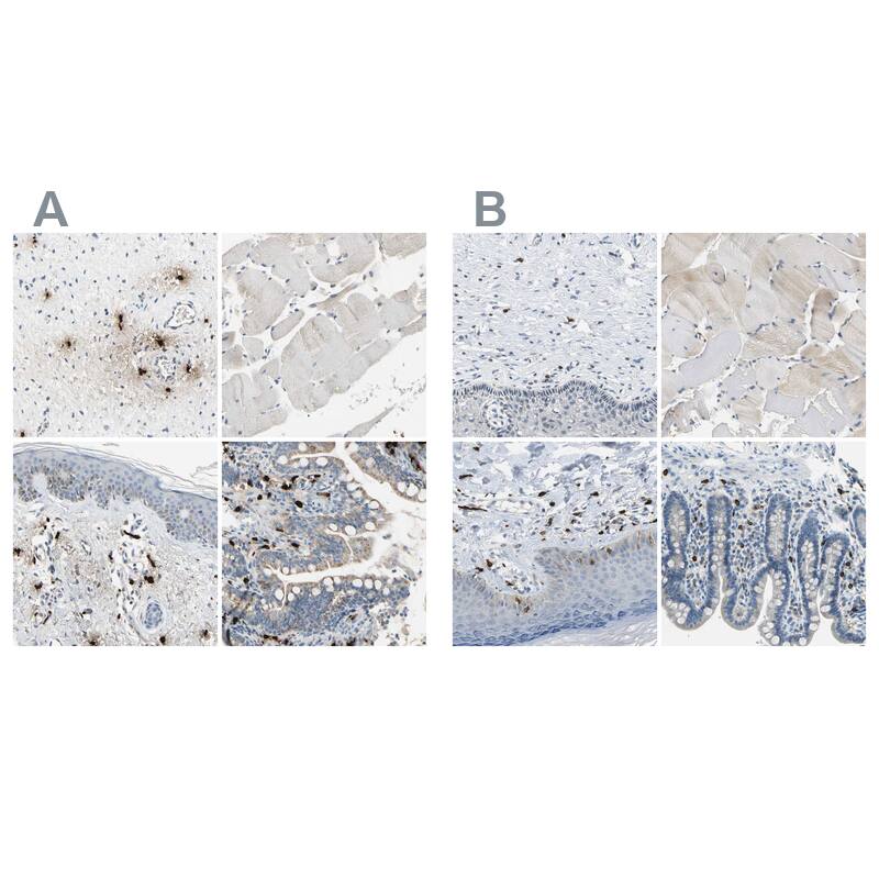 CPA3 Antibody - BSA Free Immunohistochemistry-Paraffin: CPA3 Antibody - BSA Free [NBP1-86117]