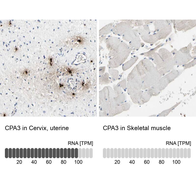 CPA3 Antibody - BSA Free Immunohistochemistry-Paraffin: CPA3 Antibody - BSA Free [NBP1-86117]