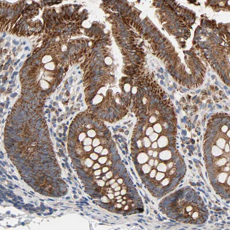GPD2 Antibody - BSA Free Immunohistochemistry-Paraffin: GPD2 Antibody - BSA Free [NBP1-86121]