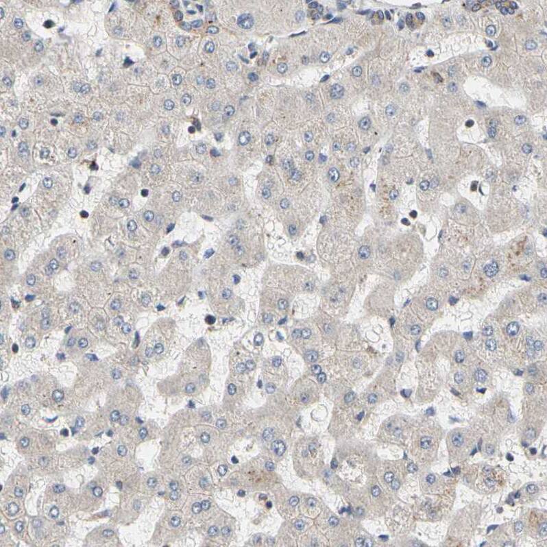 GPD2 Antibody - BSA Free Immunohistochemistry-Paraffin: GPD2 Antibody - BSA Free [NBP1-86121]