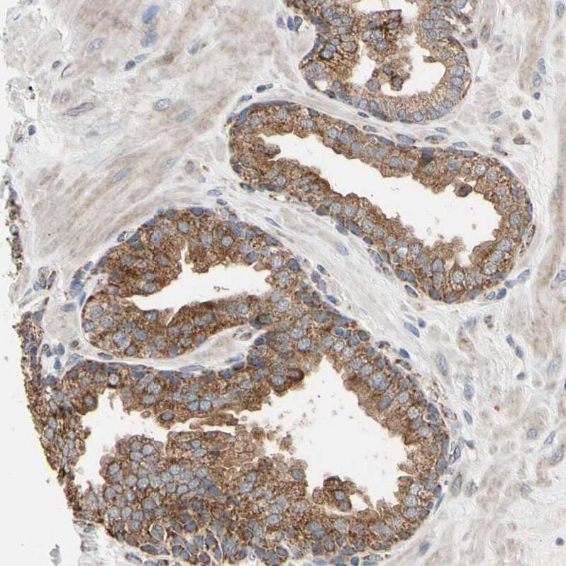 GPD2 Antibody - BSA Free Immunohistochemistry-Paraffin: GPD2 Antibody - BSA Free [NBP1-86121]