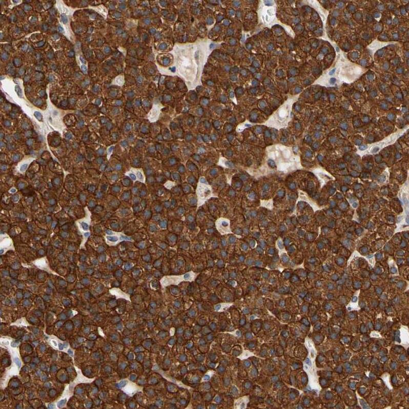 GPD2 Antibody - BSA Free Immunohistochemistry-Paraffin: GPD2 Antibody - BSA Free [NBP1-86121]