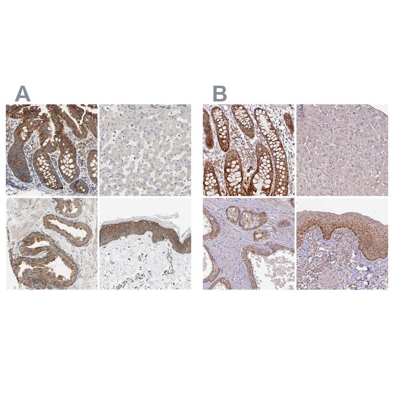 GPD2 Antibody - BSA Free Immunohistochemistry-Paraffin: GPD2 Antibody - BSA Free [NBP1-86121]