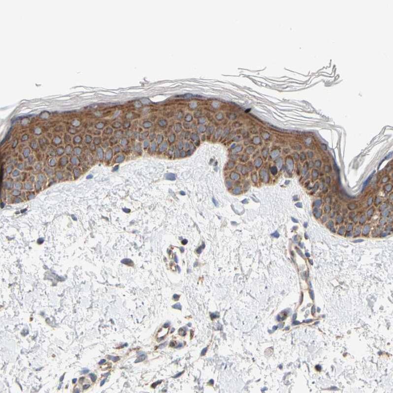 GPD2 Antibody - BSA Free Immunohistochemistry-Paraffin: GPD2 Antibody - BSA Free [NBP1-86121]