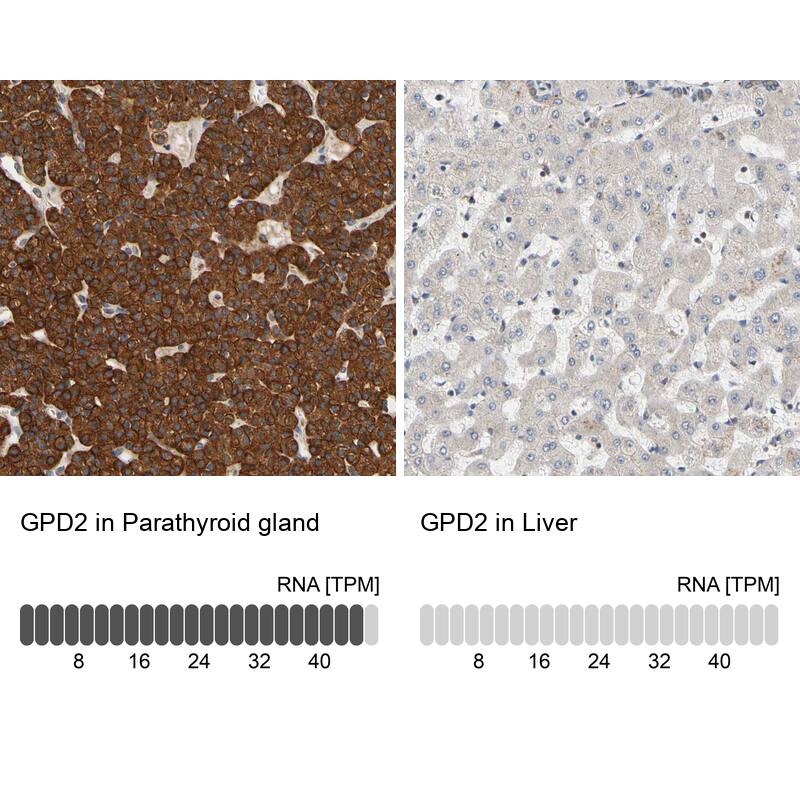 GPD2 Antibody - BSA Free Immunohistochemistry-Paraffin: GPD2 Antibody - BSA Free [NBP1-86121]