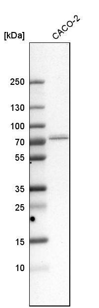 GPD2 Antibody - BSA Free Western Blot: GPD2 Antibody - BSA Free [NBP1-86121]