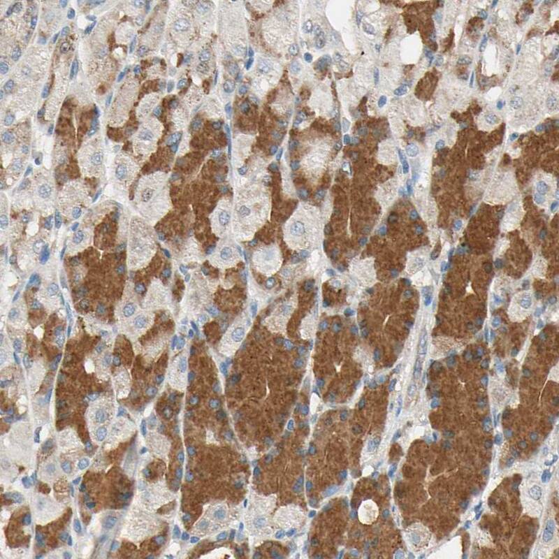 ROCK2 Antibody - BSA Free Immunohistochemistry-Paraffin: ROCK2 Antibody - BSA Free [NBP1-86124]