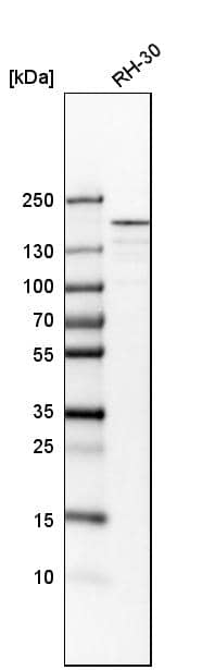 ROCK2 Antibody - BSA Free Western Blot: ROCK2 Antibody - BSA Free [NBP1-86124]