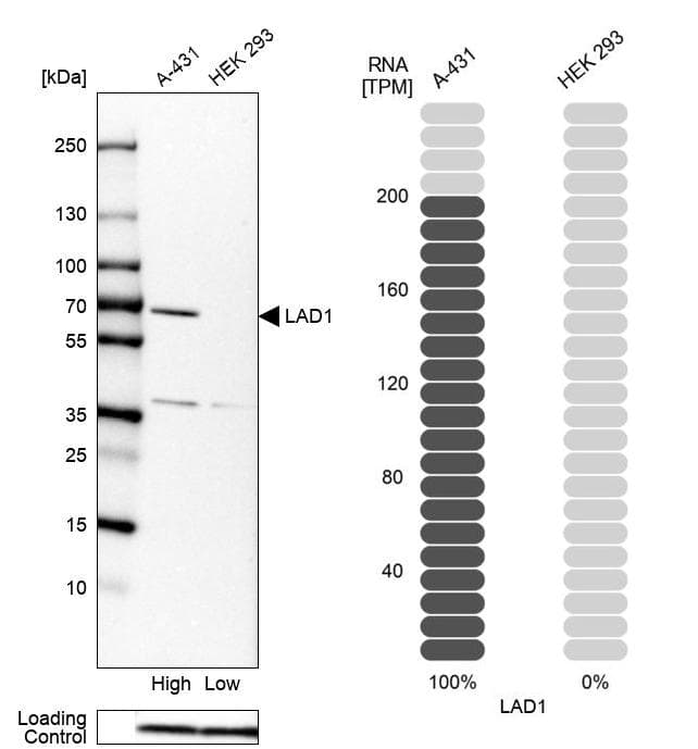LAD1 Antibody - BSA Free Western Blot: LAD1 Antibody - BSA Free [NBP1-86126]