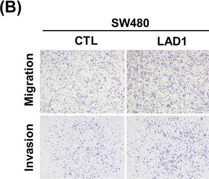 LAD1 Antibody - BSA Free