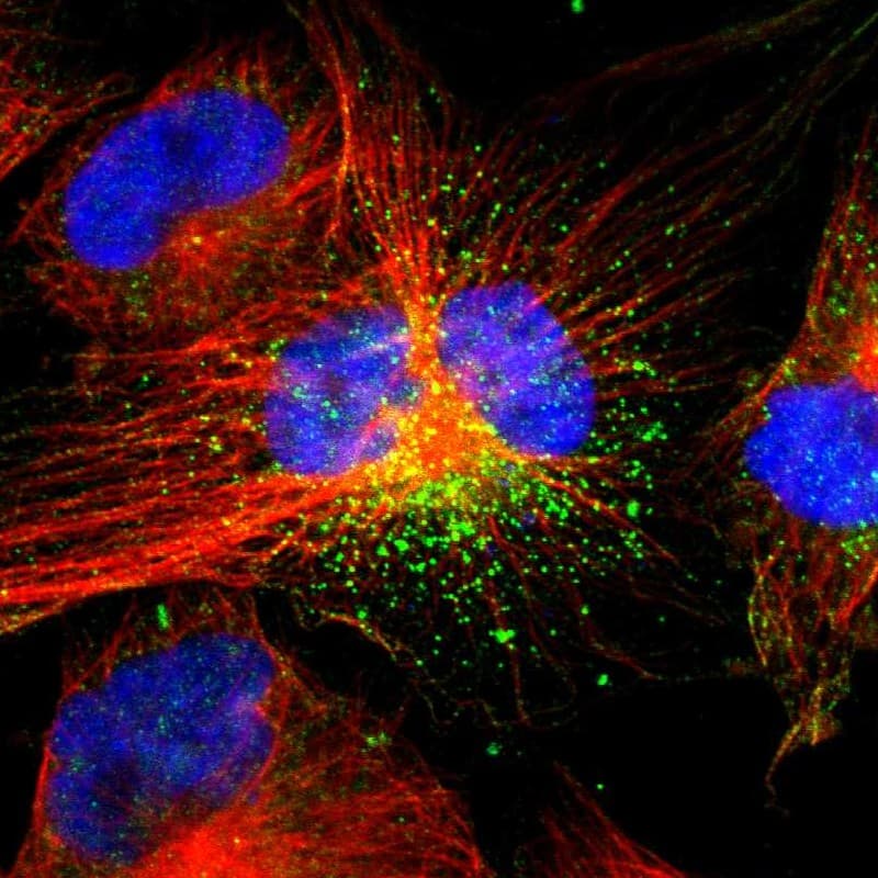 ACAA1 Antibody - BSA Free Immunocytochemistry/ Immunofluorescence: ACAA1 Antibody [NBP1-86128]