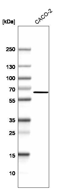 ME1 Antibody - BSA Free Western Blot: ME1 Antibody - BSA Free [NBP1-86129]