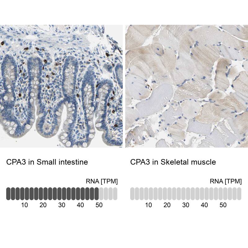 CPA3 Antibody - BSA Free Immunohistochemistry-Paraffin: CPA3 Antibody - BSA Free [NBP1-86130]