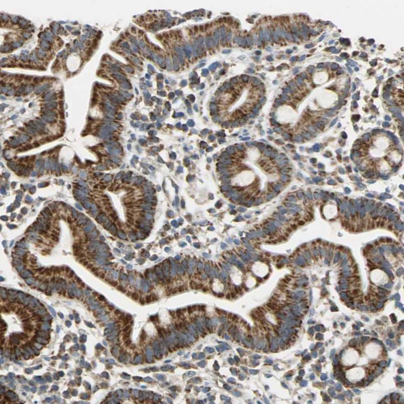 CECR5 Antibody - BSA Free Immunohistochemistry-Paraffin: CECR5 Antibody - BSA Free [NBP1-86136]