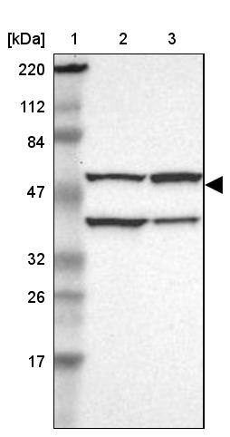 CECR5 Antibody - BSA Free Western Blot: CECR5 Antibody - BSA Free [NBP1-86136]