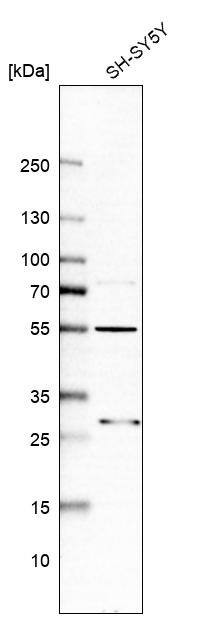 ASB6 Antibody - BSA Free Western Blot: ASB6 Antibody - BSA Free [NBP1-86141]