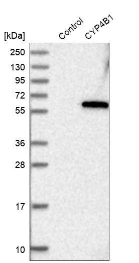 CYP4B1 Antibody - BSA Free Western Blot: CYP4B1 Antibody - BSA Free [NBP1-86142]