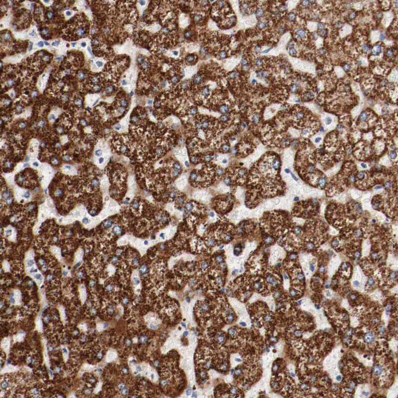 GIT1 Antibody - BSA Free Immunohistochemistry-Paraffin: GIT1 Antibody - BSA Free [NBP1-86144]