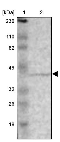ZNF222 Antibody - BSA Free Western Blot: ZNF222 Antibody - BSA Free [NBP1-86148]