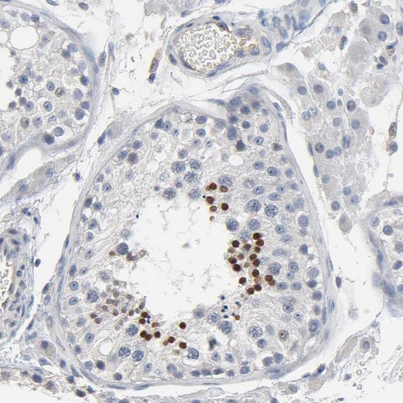 SOX6 Antibody - BSA Free Immunohistochemistry-Paraffin: SOX6 Antibody - BSA Free [NBP1-86149]