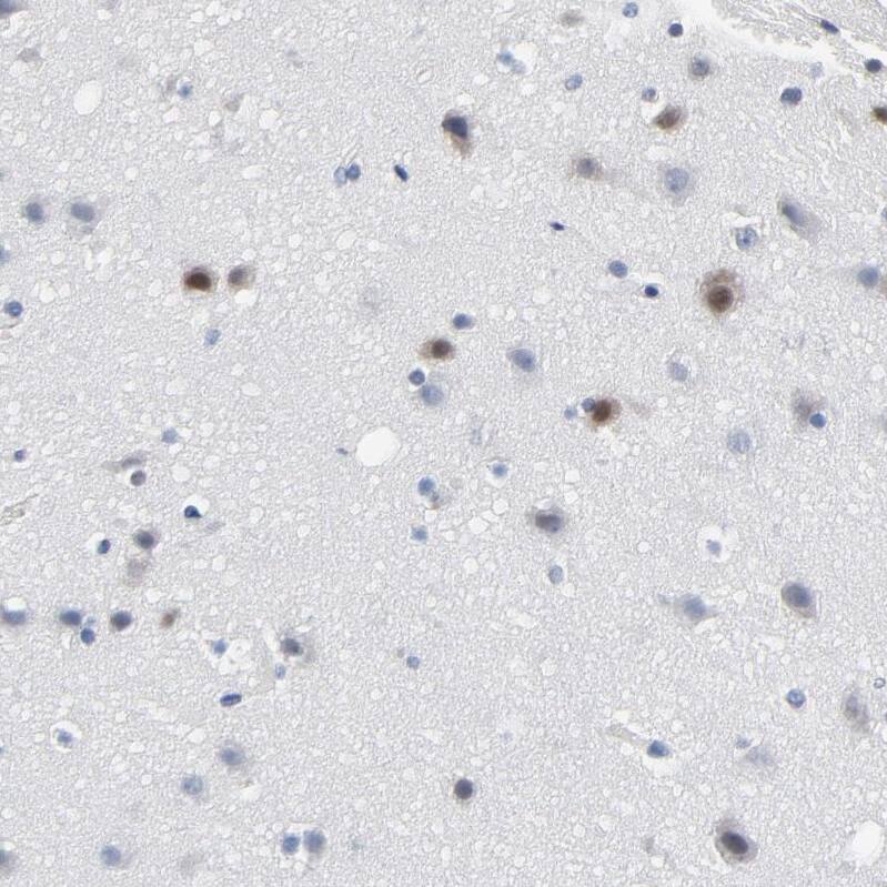 SOX6 Antibody - BSA Free Immunohistochemistry-Paraffin: SOX6 Antibody - BSA Free [NBP1-86149]