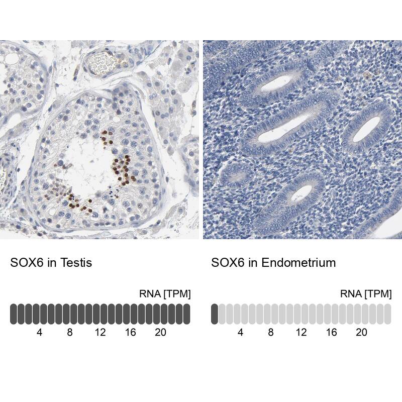 SOX6 Antibody - BSA Free Immunohistochemistry-Paraffin: SOX6 Antibody - BSA Free [NBP1-86149]