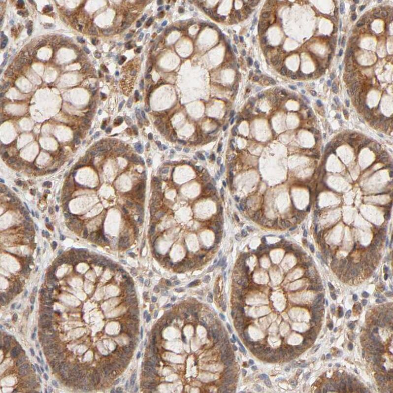 Eps8 Antibody - BSA Free Immunohistochemistry-Paraffin: Eps8 Antibody - BSA Free [NBP1-86150]