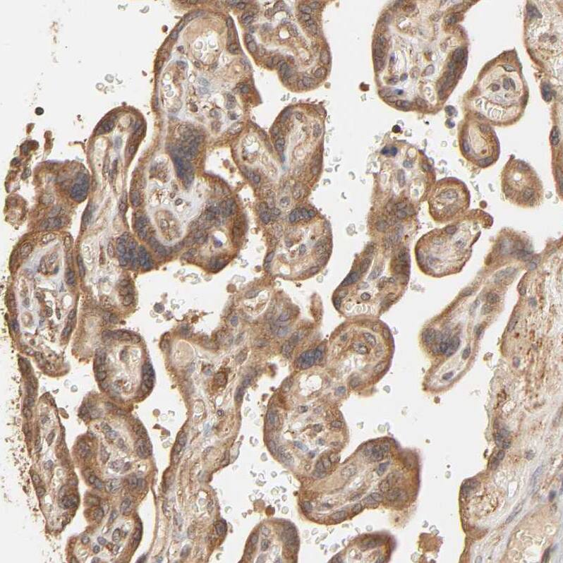 Eps8 Antibody - BSA Free Immunohistochemistry-Paraffin: Eps8 Antibody - BSA Free [NBP1-86150]