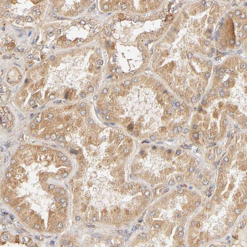 Eps8 Antibody - BSA Free Immunohistochemistry-Paraffin: Eps8 Antibody - BSA Free [NBP1-86150]