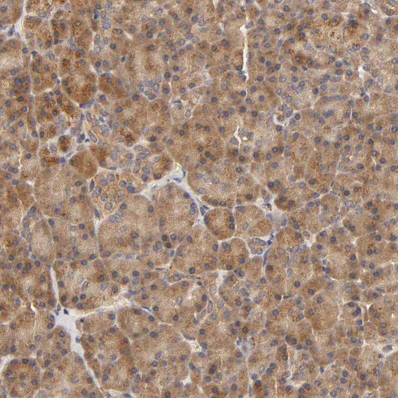 Eps8 Antibody - BSA Free Immunohistochemistry-Paraffin: Eps8 Antibody - BSA Free [NBP1-86150]